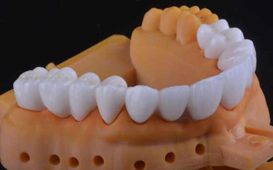 kopen Hoge sterkte Zirconia tandkroon Ultratranslucent met langdurige stabiliteit online vervaardiging