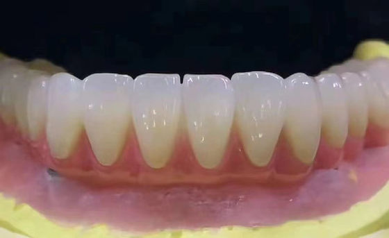 kopen Gepersonaliseerd tandheelkundig Zirconia tandkroon Vlekbestendig met hoge precisie online vervaardiging