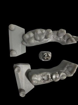 kopen Corrosiebestendige metalen post en kern met hoge hechting voor tandheelkundige herstel online vervaardiging