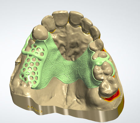 kopen Digitaal metaal frame CAD CAM tandheelkundig ontwerp Cocr materiaal met 3D-printen online vervaardiging