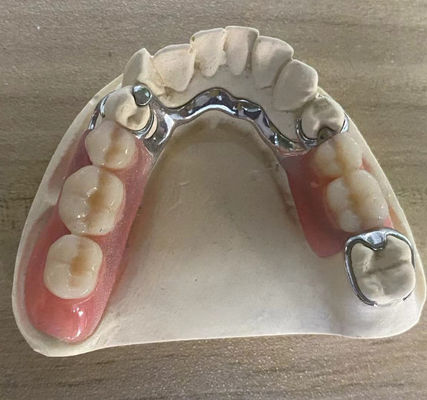 kopen Betrouwbare zilveren metalen gebit, corrosiebestendig met aanpasbaar ontwerp online vervaardiging