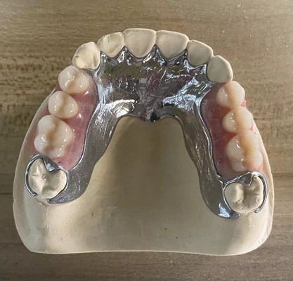 Hoogsterkte giet metaal gedeeltelijke tandheelkunde Cocr Aolly Met 3D-printen