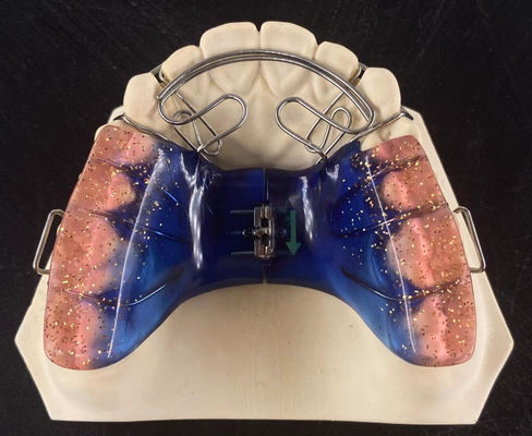 Hoge nauwkeurigheid orthodontisch verwisselbaar apparaat Veiligheid Clear Hawley Retainer