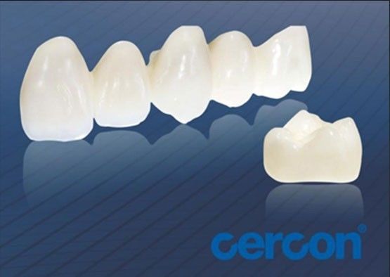 slijtvastheid CAM Cercon Zirconia kronen Makkelijk schoonmaken Hoge biocompatibiliteit