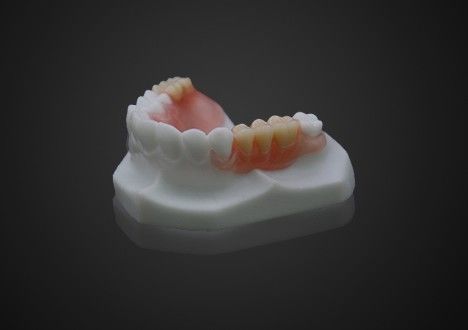 Lichte, comfortabele Valplast gedeeltelijke prothese, gemakkelijk schoon te maken, hoog transparantie