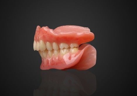 Onmiddellijke adsorptieve acrylbasis gedeeltelijke tandheelkunde verwijderbaar en comfortabel