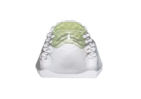 Gepersonaliseerde orthodontische functioneel apparaat verwijderbaar vlak gidsvlak