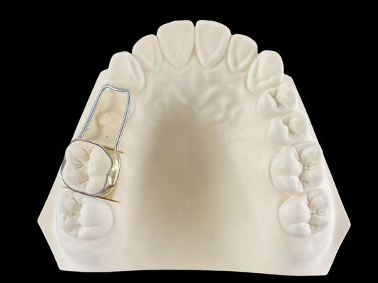 Flexible band and loop space maintainer verstelbaar orthodontisch functionele apparaat