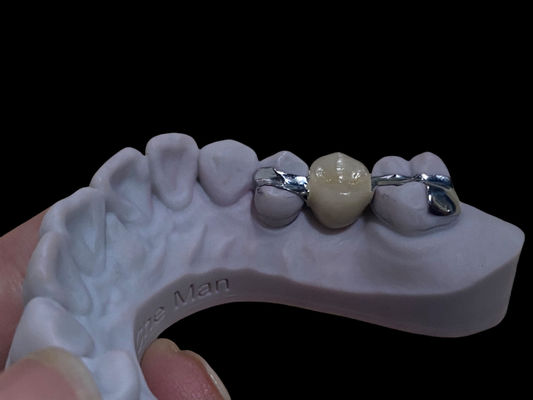 Precieze witte langdurige Maryland brug tandheelkundige aanpasbaar voor herstel