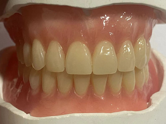 Hypoallergene aangepaste verwijderbare gedeeltelijke tandheelkunde met roze tandvleeskleur