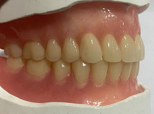 Gepersonaliseerde natuurlijke volledige tandheelkundige acryl tanden voor optimale bewaring