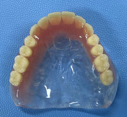 Vlekbestendigheid Volle acrylprothese Hoge stabiliteit met volle boogvorm