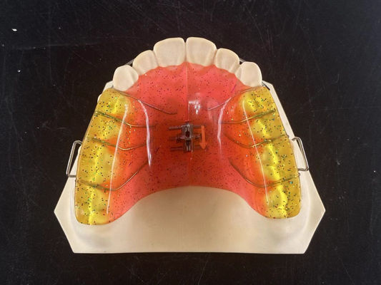 Gepersonaliseerd 2 Ways Tental Arch Expander Verstelbaar orthodontisch apparaat
