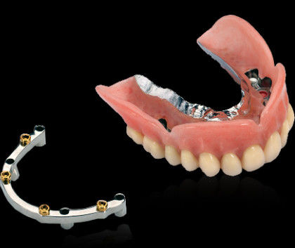 Gemaalde titanium tandheelkundige implantaten met een glad gepolijst oppervlak